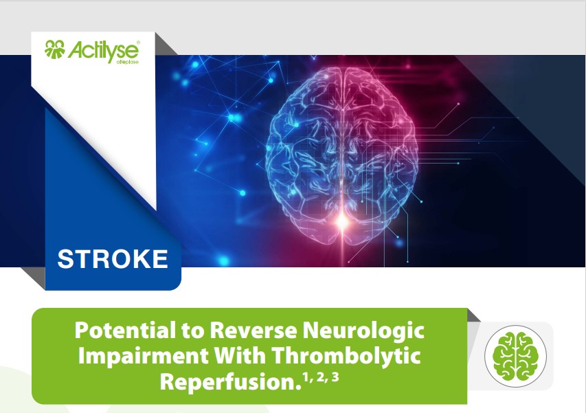 fue_thrombolysis with rt-pa_e-ct1_ss1.jpg